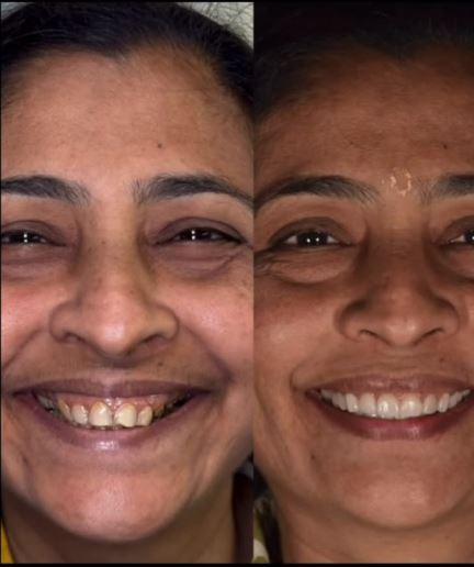 General Preventive Dentistry