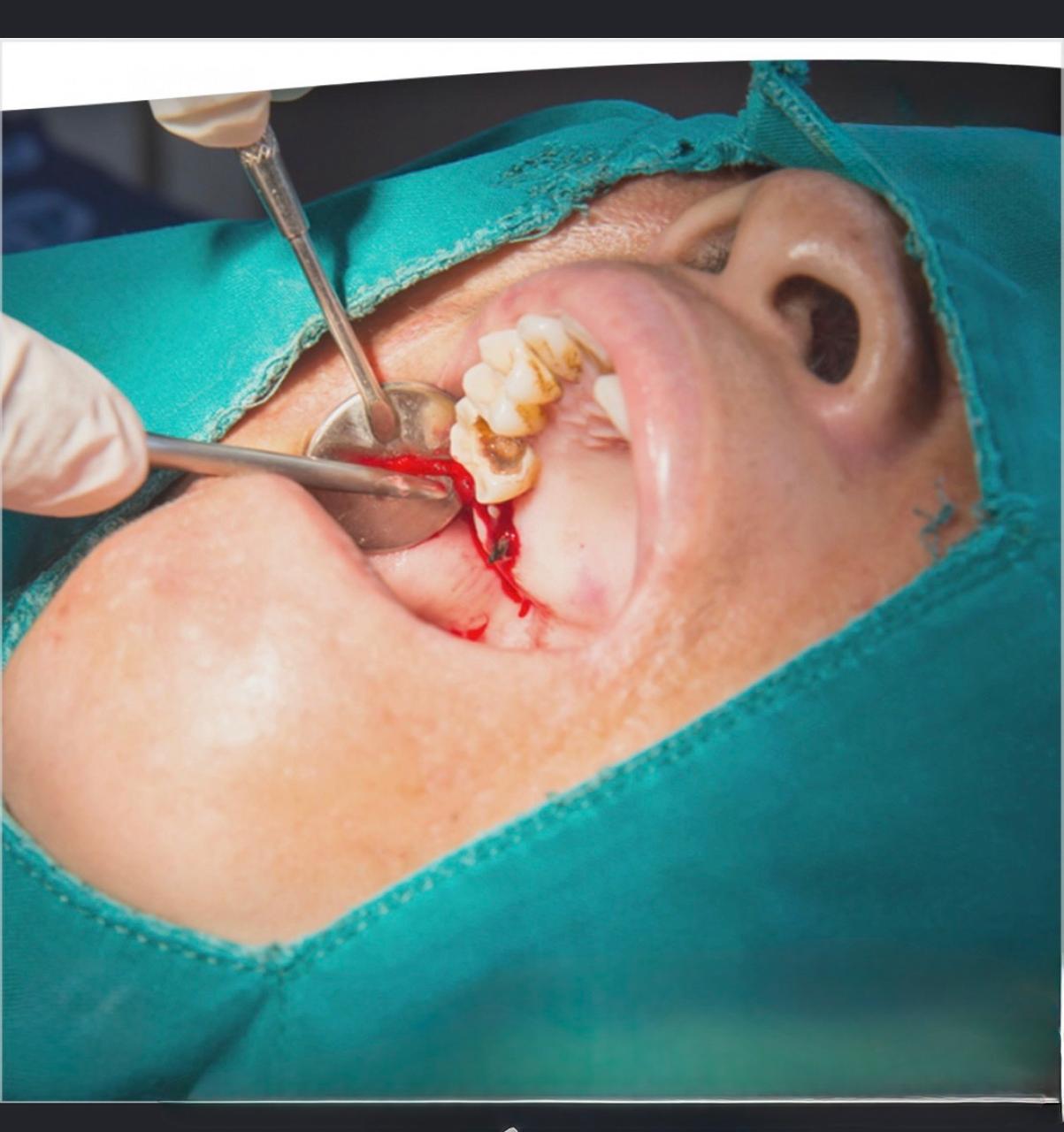 Oral Surgery & Care